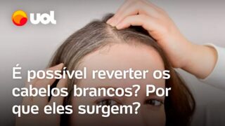 Cabelo branco: é possível reverter? Estresse, sono irregular e má alimentação influenciam; confira